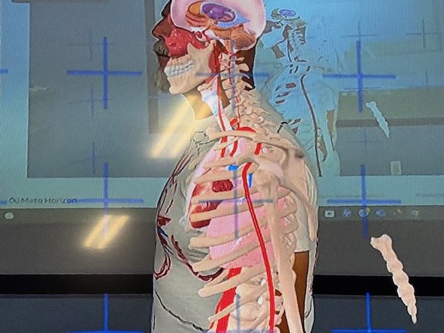 X RAY 6